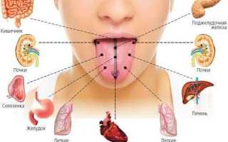 Причины, по которым язык обложен белым налетом: состояние нормы и возможные заболевания
