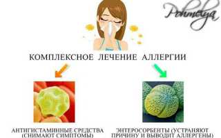 Симптомы алкогольной крапивницы: как быстро избавиться