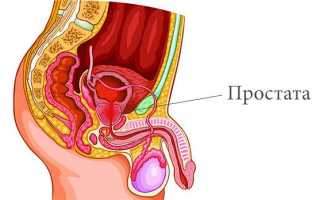 Причины и лечение гипотермии простаты
