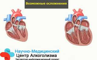 Признаки алкогольной кардиомиопатии: лучшие методы лечения