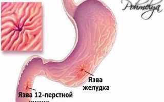 Алкоголь и пищеварительная система