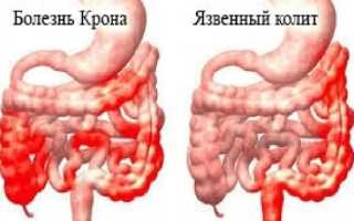 Отделы толстого кишечника: особенности развития и возможные заболевания