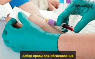 За сколько дней до сдачи анализа крови нельзя пить алкоголь