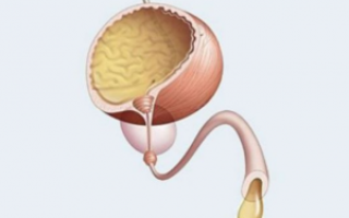 Причины, симптомы, виды и лечение выделений при простатите