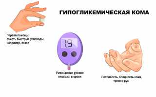 Что делать при гипогликемической коме