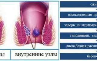 Что приводит к неполному опорожнению кишечника: методы лечения в зависимости от причины