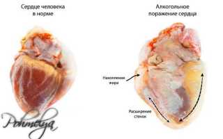 Негативное влияние алкоголя на сердце. Миф или реальность