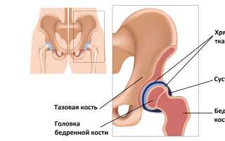 ТОР часто задаваемых вопросов о тазобедренном суставе