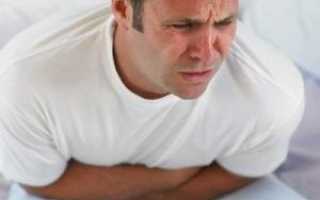 Особенности проявления аппендицита у мужчин