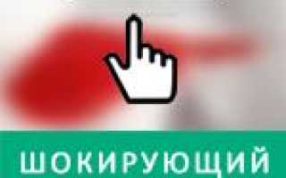 Что делать, если на трусах белые выделения: признаки нормы и нарушений