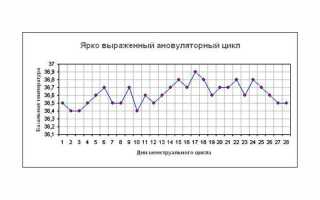 Ановуляторный цикл – причины, симптомы, диагностика и лечение