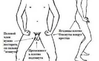 Почему у мужчин может наблюдаться непроизвольное мочеиспускание