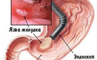 Боль в верхней части живота – жалоба, с которой стоит обратиться к врачу