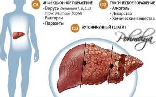 Симптомы и методы лечения алкогольного гепатита