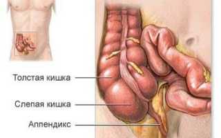 Особенности диагностики аппендицита у женщин или как его не пропустить