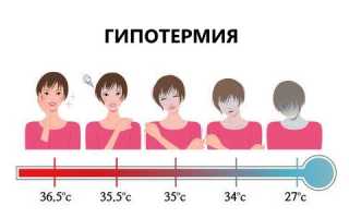 Симптомы гипотермии разной степени тяжести