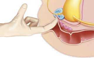 Массаж простаты пальцем для самого себя: техника проведения на видео с отзывами мужчин