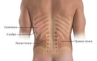 ТОП-10 причин болевого синдрома в области почек