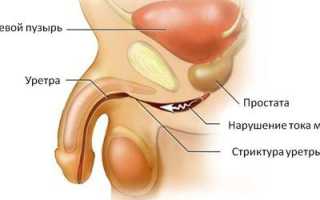 Паховое переохлаждение у мужчин